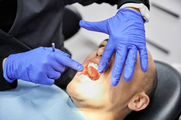 Best Emergency Tooth Extraction in Lucerne, CA