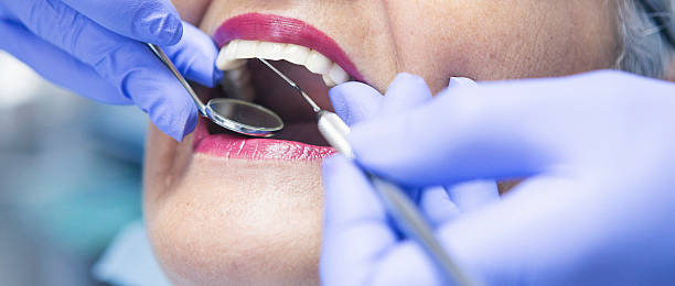 Best Same-Day Emergency Dental Services in Lucerne, CA